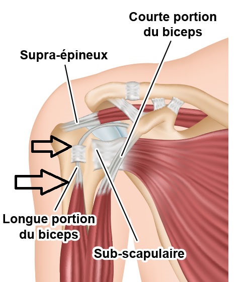 tendinite-de-lepaule-ill1.jpg