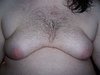 man boobs teen.jpg