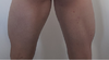 juillet 2015 3sischios.png